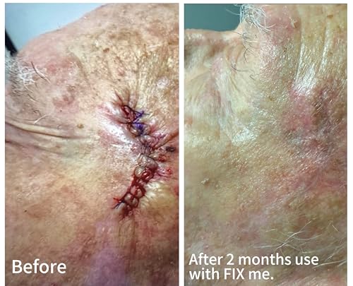 The Skin Experts- FIX ME - Advanced Scar Cream- Dermatologist developed by Dr. Alexander Dane