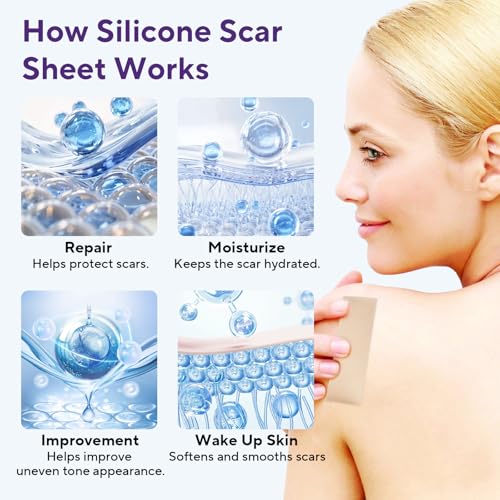 Silicone Scar Sheets, Silicone Scar Tape (1.6"x 60" Roll-1.5m) 1.5M