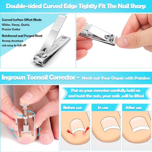 Modacraft 11-Piece Toenail Care Kit - Effective Ingrown Toenail Treatment with Toenail Clippers for Thick Toenails, Corrector & Other Pedicure Tools for Feet and Hand 11Pcs/set Ingrown Toenail Tools Kit