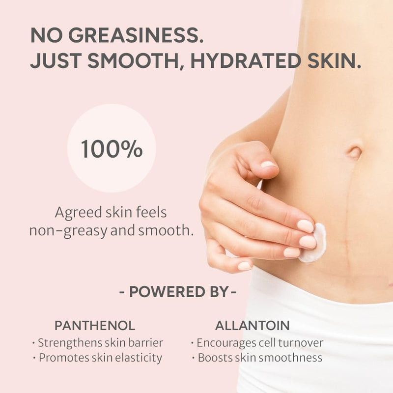 Advanced Stretch Mark Cream for Pregnancy, Weight Gain, Growth Spurts - Pregnancy-Safe - Korean Skincare - Clinically Proven - Ultra Clean Ingredients - Fragrance Free - Vegan - 6.76 fl oz - BeesActive Australia