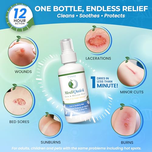 MediQuick Hypochlorous Acid Spray Mist, Antiseptic Spray No-Sting, 4 oz Skin & Wound Mist (4 Ounce)