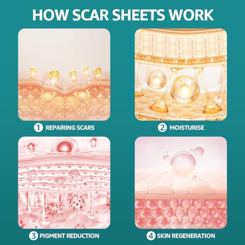 Silicone Scar Sheets, Silicone Scar Tape for Surgical, Hypertrophic, Keloid, C-Section, Burn, Old & New Scars, Reusable Scars Removal Sheets