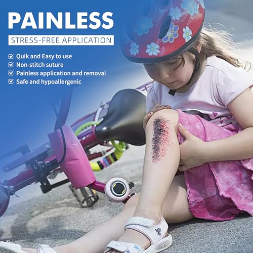 2 Pcs Emergency Laceration Closures,Butterfly Bandaids Wound Closure,Surgical Laceration Repair Without Sew,Quick Clot,Emergency Wound Closures Device (PU) 2 Count (Pack of 1)