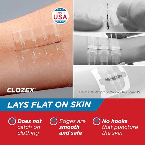 Clozex Emergency Laceration Kit - Repair Wounds Without Stitches, Skin Closure Device for a Wound Up to 1 1/2 Inches Length. Complete Kit to Clean, Close, & Cover Wounds 1.5 Inch