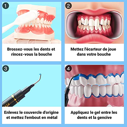 Teeth Whitening Gel Kit: Whitening Refill Gel and Dental Gingival Barrier Protection Gel- No Sensitivity Teeth Whitening and Protection for a Brighter Whiter Smile