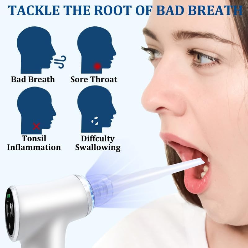 Tonsil Stone Remover Tool, Upgraded Electric Tonsil Stone Removal Kit - with Built-in LED Light & 6-Level Suction for Bad Breath Prevention Blue