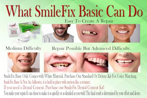 SmileFix Basic Dental Repair for Missing or Damaged Teeth - Fix Gaps, Missing Teeth, Spaces, Broken Tooth - Fast & Easy - Confident Smiles - Durable Compound - Thermoplastic Beads