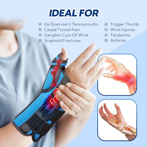 Thumb Spica Splint, De Quervain's Tenosynovitis Brace, Carpal Tunnel Wrist Brace with Thumb Support, Wrist and Thumb Brace for Trigger Thumb, Arthritis, Wrist Fractures, Injuries, Right-S S