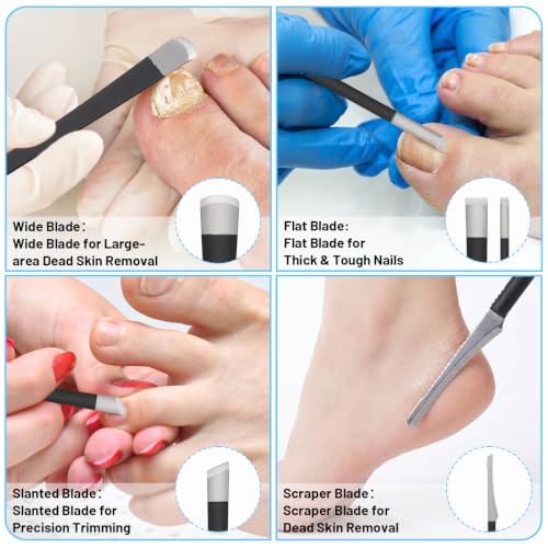 6Pcs Ingrown Toenail Removal Kit, Pedicure Tool Feet Corn Remover
