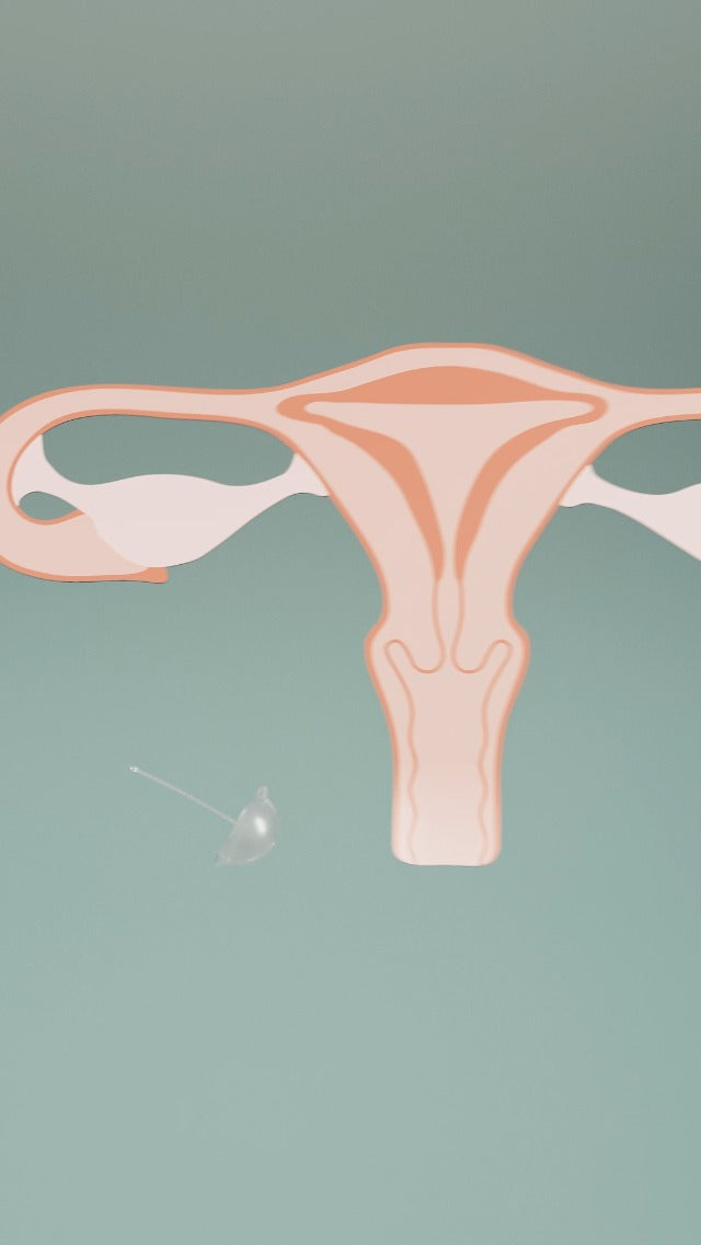 Frida Fertility Conception Aid Cup for Natural Pregnancy Support, Storage