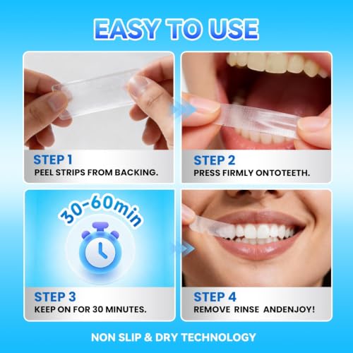 Teeth-Whitening Strips for Sensitive Teeth - Teeth Whitening Kit Professional Effects, Teeth Whitener for Enamel Safe, 14 White Strips (7 Day Treatment) Remove Stains for a Brighter Smile, Mint 14 Count (Pack of 1)