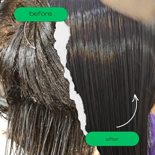 My Hair Helpers Unscented Dimethicone Oil Lice Treatment, 8 fl Ounces 8 Fl Oz