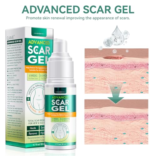 Scar Gel, Scar Removal Cream, Scar Treatment for Surgical Scars, Acne, Burn, C-Section, Keloid, Burn, Acne, Tummy Tuck, Remover Scar for Old or New, Kids, Men, Woman, 50Ml