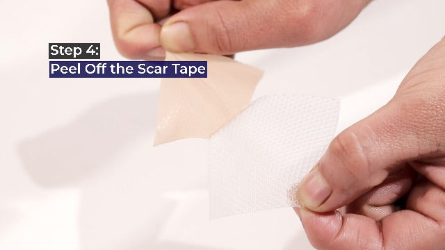 GauzeCare Silicone Scar Tape – 1.6”x60” Roll – Medical-Grade, Reusable, Professional Silicone Scar Tape for Surgical Scars, C-Section, Burns, Keloid, and Acne Scars 1.6"x60" - 1 Roll