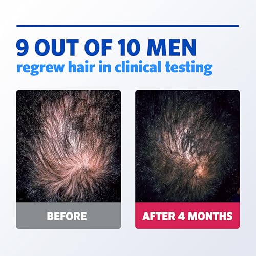 Men's Rogaine 5% Minoxidil Foam, 1-Month Supply, 2.11 oz 2.11 Ounce (Pack of 1)