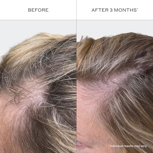 Zenagen Revolve Women's Travel Duo | For Fine & Thinning Hair, 2.5 Fl Oz