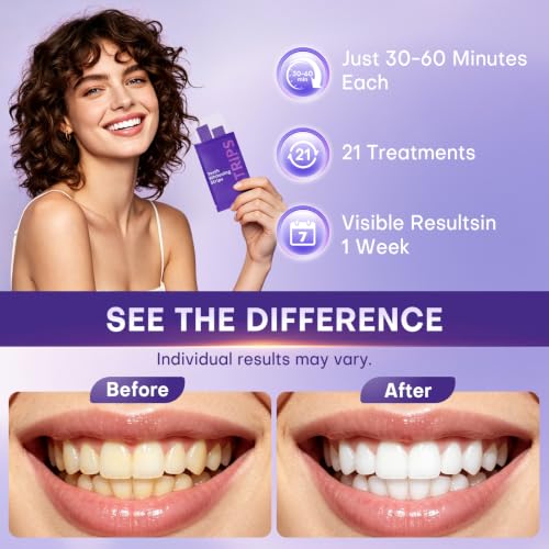 Purple Teeth Whitening Strips 42 Count, Removes Yellow Teeth Stains