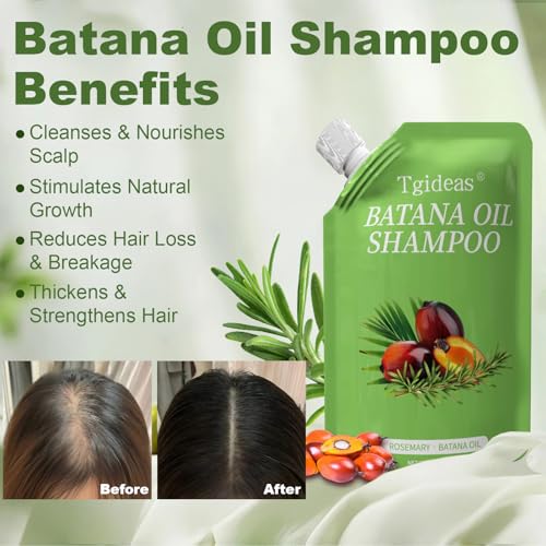 Tgideas Batana Oil Rosemary Shampoo for Hair Growth, Thinning Hair, 2 Pack