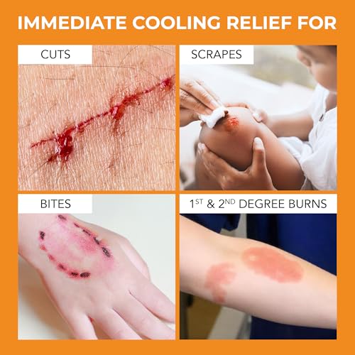 Medagel The Original Moist Burn Pad - Hydrogel Healing Pads, Soothing & Moist Skin Care Patch for Burns & Wounds, 2” x 3” Dressing 2x3