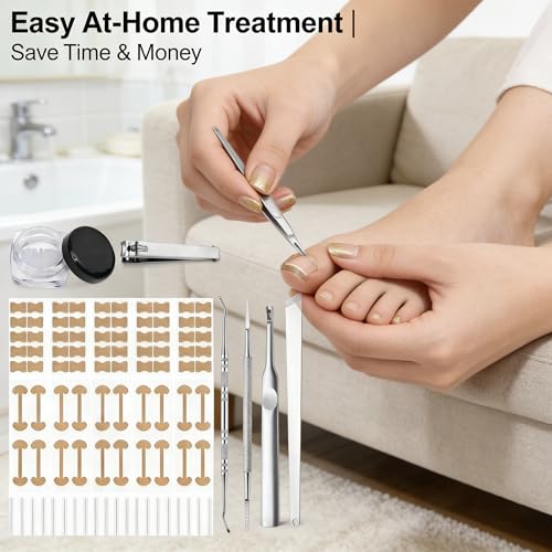 Ingrown Toenail Corrector Kit - Professional Painless Correction Strips & Pedicure Tools for At-Home Care