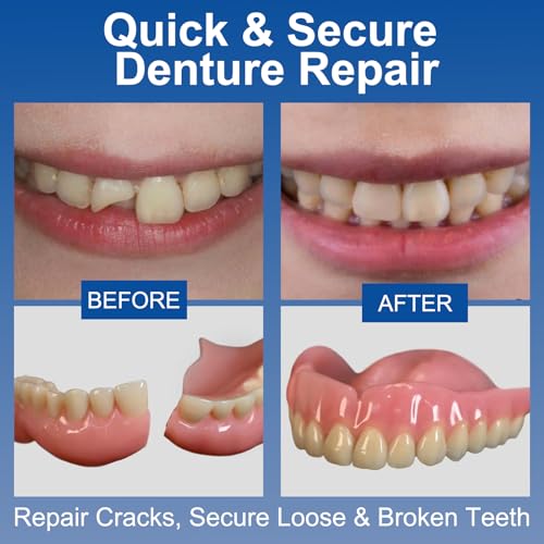 Dental Lab Instant Bonding Dental Glue (1oz), Repair Cracks & Secure Loose Teeth, Super-Strong Adhesive—Lasts Days to Weeks