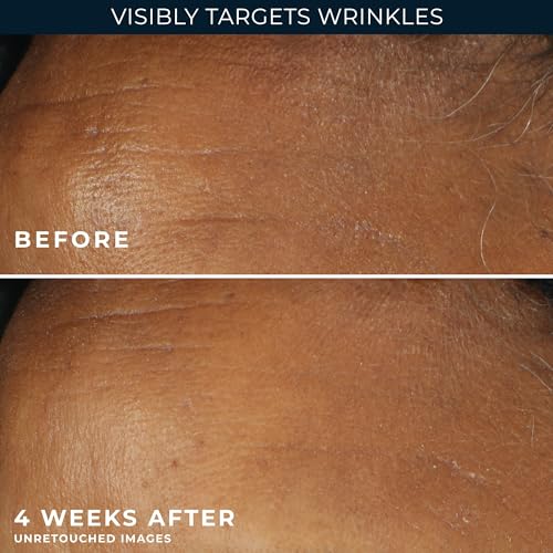 RoC Retinol Correxion Deep Wrinkle Daily Face Moisturizer SPF 30, 1 oz Deep Wrinkle Daily Moisturizer