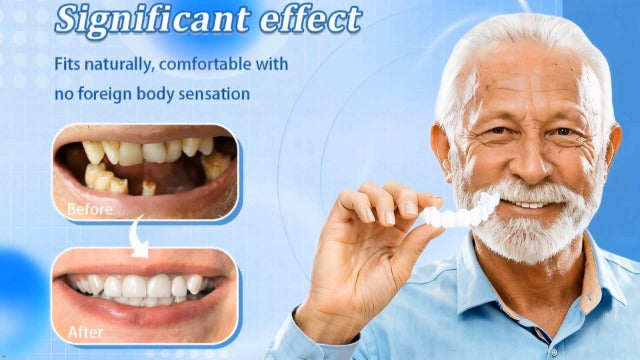 2 Pairs Temporary Smile Support Adjustable for All Genders, Nature and Comfortable Regain Confidence Smile(White)