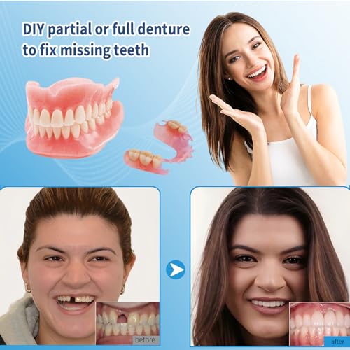 Kaimloyou DIY Denture Full Set of Top and Bottom Fake Teeth,Advanced Formula Fitting and Moldable to Make Customized Partial of Full Denture For Fixing Missing Teeth