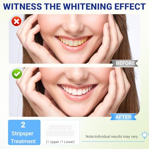 Teeth Whitening Strips Kit Sensitive,Non-Slip Enamel-Safe for Whiter Teeth 1 Count (Pack of 21)