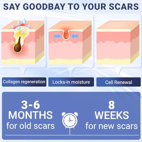 Scar Cream, Silicone Scar Gel, Advanced Scar Removal Cream for Surgical Scars, Stretch Marks Removal, Keloid Bump Removal, Old and New Scars 2.04 Oz (58g) Scar Cream 2.04 Ounce
