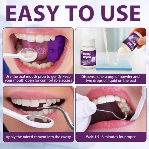 Dental Care Kit Zinc Oxide Eugenol Cement, Temporary Tooth Repair Kit for Crowns Filling, Temporary Teeth Fix for Confident Smile Purple