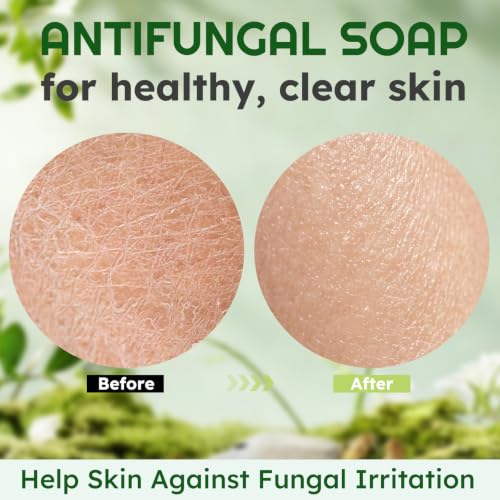 Antifungal Soap, Antibacterial Soap Bar with Tea Tree Oil, 2 Bars 4.1 Ounce (Pack of 2)