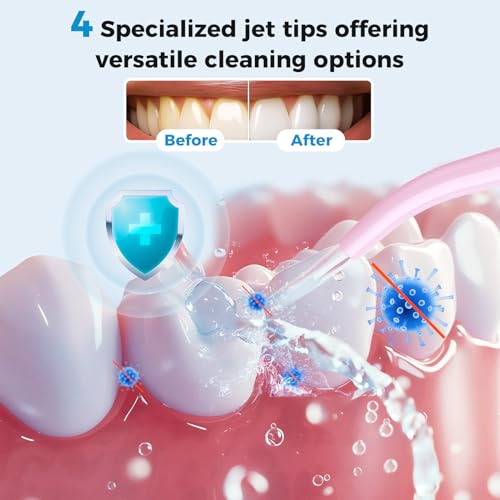 LINKEVAP Water Flosser for Teeth Pick,360ML Rechargeable Travel Oral Irrigator Cleaner,IPX7 Waterproof Daily Dental Care Machine for Home (Pink) Pink