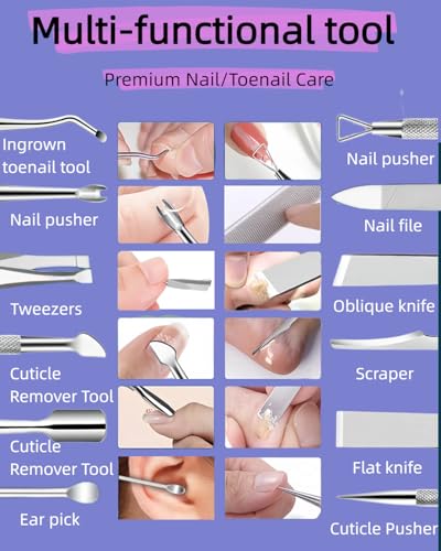 10 Pcs Ingrown Toenail File and Lifters, Ingrown Toenail Removal Kit, Pedicure Tools for Feet with Callus/Dead Skin/Corn Removal, Nail Correction, Polishing & Pain Relief - Stainless Steel with Case