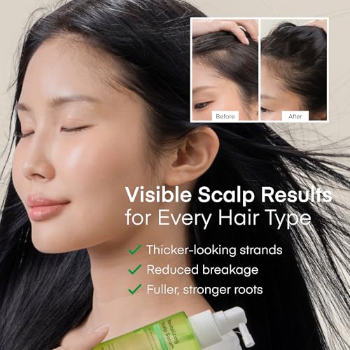 Scalp Serum for Hair Growth Spray – Korean Vegan Treatment for Hair Loss, Thinning & Itchy Scalp, Non-Greasy, Lightweight Formula to Exfoliate Dandruff & Strengthen Roots – For Men & Women (100 mL) 3.38 Count (Pack of 1)