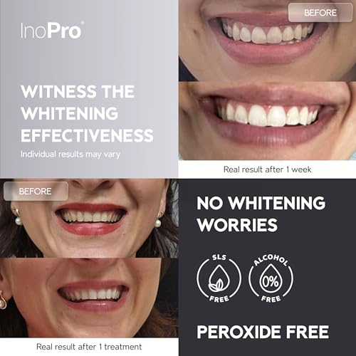 InoPro Advanced Teeth Whitening 21 Treatments Kit + Natural Whitening Hydroxyapatite Toothpaste with Probiotic for Sensitive Teeth 5oz