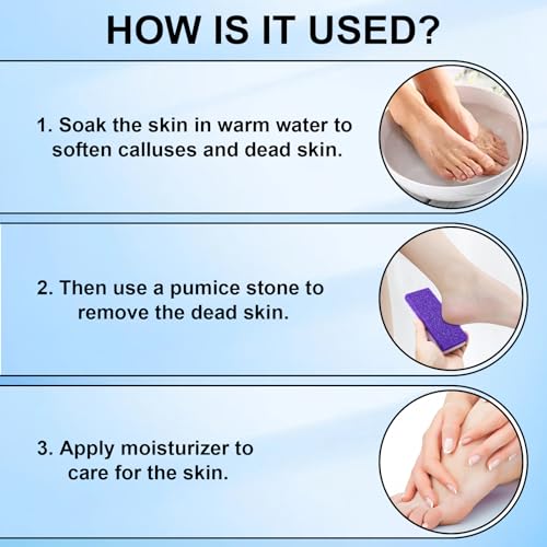 Foot Pumice Stone 2 Pack Pedicure Stone for Feet (Purple) Purple 1 Count (Pack of 2)