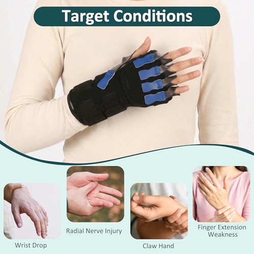 Radial Nerve Palsy Splint Wrist Drop Brace for Finger Extension, Adjustable Stroke Hand Recovery Device for Finger Limp, Wrist Drop, Crutch Palsy, Resting Hand MCP Splint Fits Left/Right