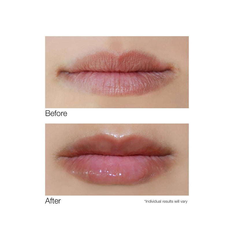 Dermelect Smooth Lip Volumizer for Lips - Anti Aging Plumper with Argan Oil, Shea Butter, Coconut Oil, Hyaluronic Acid Vitamin C Silkflo Hydrating Conditioning Lip Primer for Dryness Thin Lips .24 oz