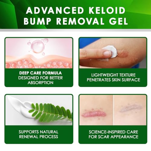 Tobcharm Advanced Keloid Bump Removal: Silicone Keloid Scar Removal Cream for Scars from Piercing, Surgical Marks, Acne, and Burns, Keloid Treatment for Ears, Face, and Body with Healing Formula 30g 1 Fl Oz (Pack of 1)