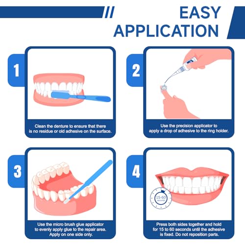 Dental Lab Denture Repair Glue Kit (1oz), Instant Bonding Denture Adhesive, Repair Cracks and Secure Loose Teeth, Safe Bonding No Irritating Odour