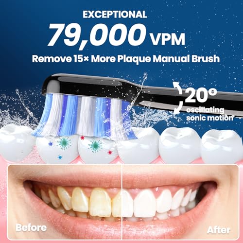 Electric Toothbrush with Pressure Sensor, Black