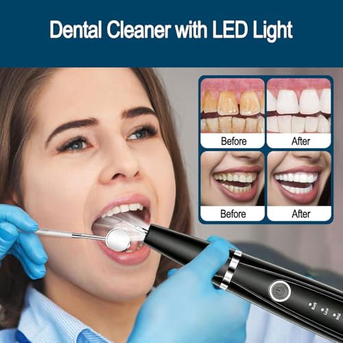 Sonic Dental Cleaner, Dental Cleaner with LED Light, 5 Modes Teeth Cleaning Tool, 3 Replaceable Heads for Home & Travel, IPX6 Waterproof