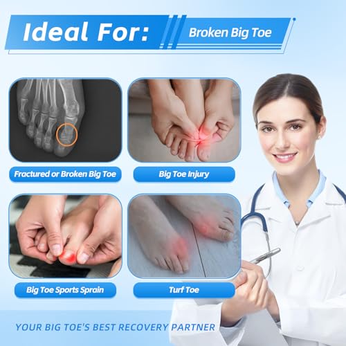 Big Toe Brace Splint for Broken, Turf Toe, Fracture, Arthritis, Sprains, Support for Women & Men, with 2 Removable Metal Plates - Blue Left