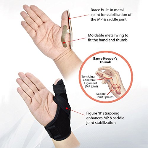 U.S. Solid Thumb Spica Splint- Thumb Brace for Arthritis or Soft Tissue Injuries, Lightweight and Breathable, Stabilizing and not Restrictive, Fits Both Hands, a Product (Large/XL) (Pack of 2) Large/X-Large (Pack of 2)