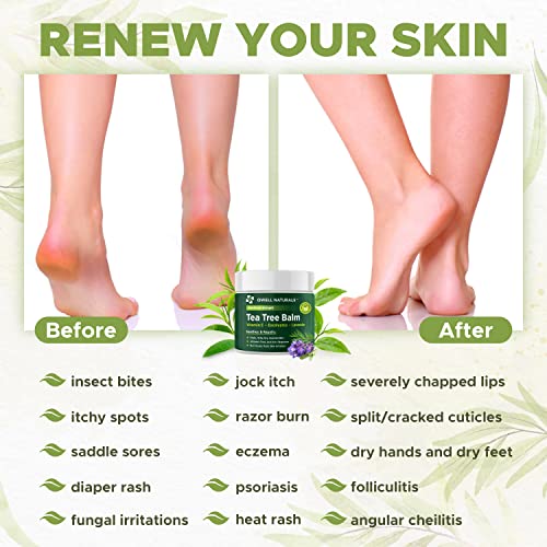 Owell Naturals Tea Tree Antifungal Balm – Extra Strength for Athlete’s Foot, Jock Itch, Ringworm & Skin Fungus – Soothing for Itchy, Dry, Cracked Skin, Feet & Body, 2 oz 2 Fl Oz (Pack of 1)