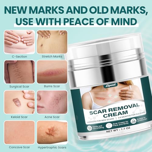 Scar Cream Gel Silicone Removal for Surgical Scars Burn Old Scars Acne Face Stretch Marks Hypertrophic Keloid wait Silicone Gel For Scars Topical Remover 2Pack 1.7 Oz