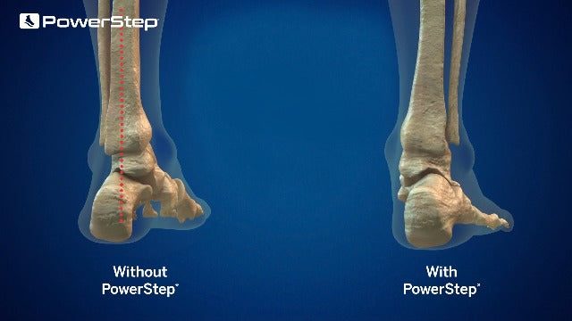 PowerStep Pinnacle Insoles, Plantar Fasciitis Relief (M 8-8.5, W 10.10.5) Blue Men's 8-8.5, Women's 10-10.5