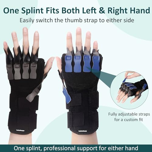 Radial Nerve Palsy Splint Wrist Drop Brace for Finger Extension, Adjustable Stroke Hand Recovery Device for Finger Limp, Wrist Drop, Crutch Palsy, Resting Hand MCP Splint Fits Left/Right