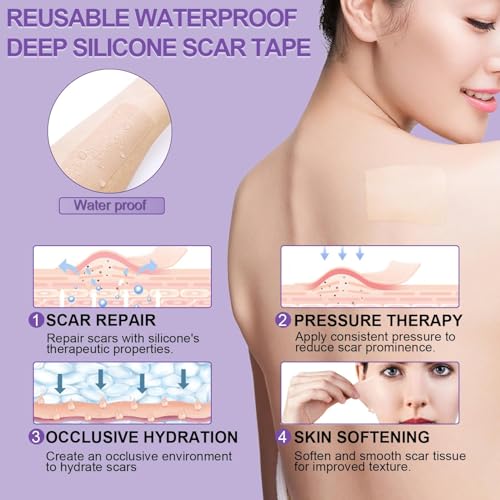 Silicone Scar Sheets, Medical Grade Silicone Scar Tape (1.6" x 120"), Professional Scar Removal Treatment, Reusable, for Healing Keloids, Surgeries Scars, C-sections, and Burns 1.6" x 120"